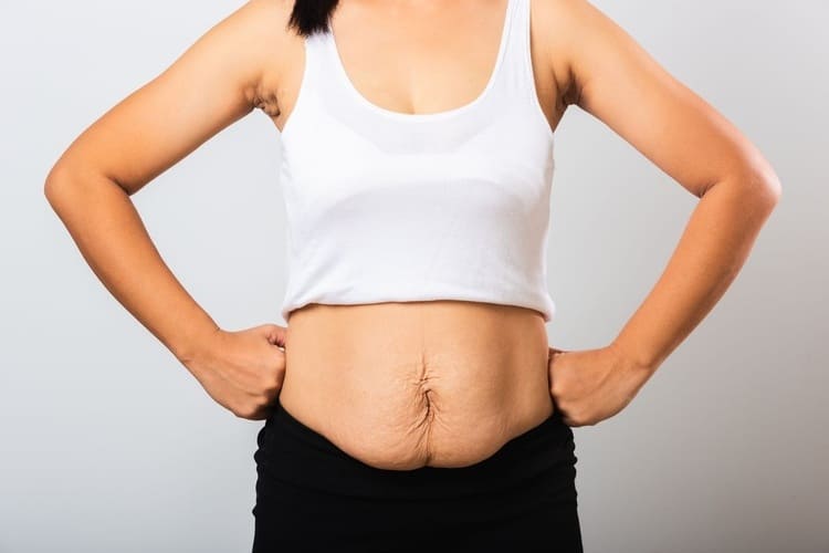 Close Up of Woman's Torso Showing Lower Belly Pooch